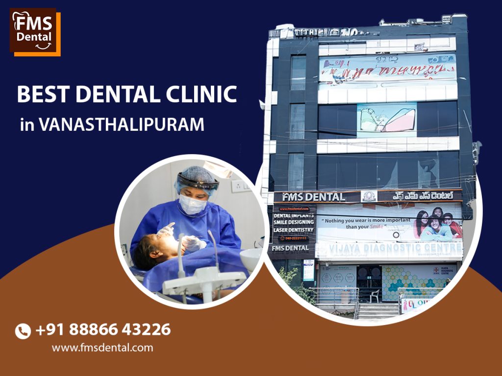 Best Dental Clinic in Vanasthalipuram, Best Dental Hospital in Vanasthalipuram, Best Dentist in Vanasthalipuram